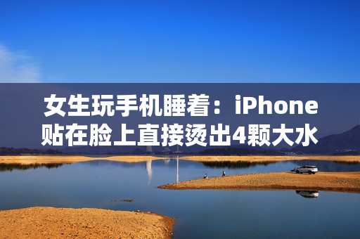 女生玩手机睡着：iPhone贴在脸上直接烫出4颗大水泡！