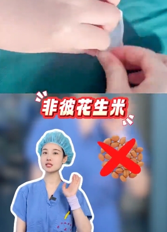 手术室为什么要用花生米 花生米起什么作用 - php中文网
